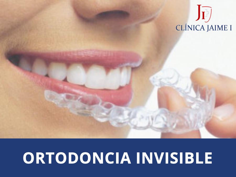 invisalign, la ortodoncia invisible como solución a tus miedos
