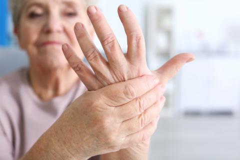 artritis reumatoide clinica jaime i catarroja