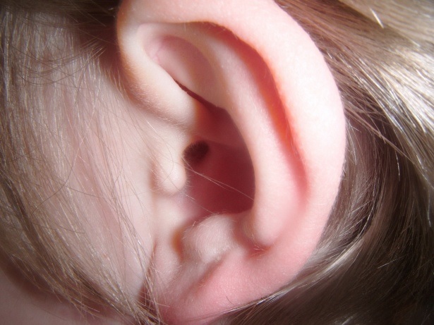 Cómo eliminar la cera de los oídos