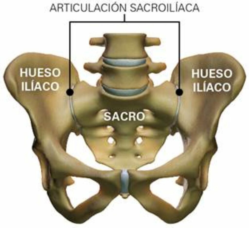 sacroileitis 