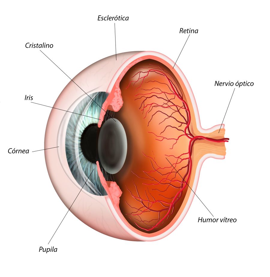 glaucoma-valencia