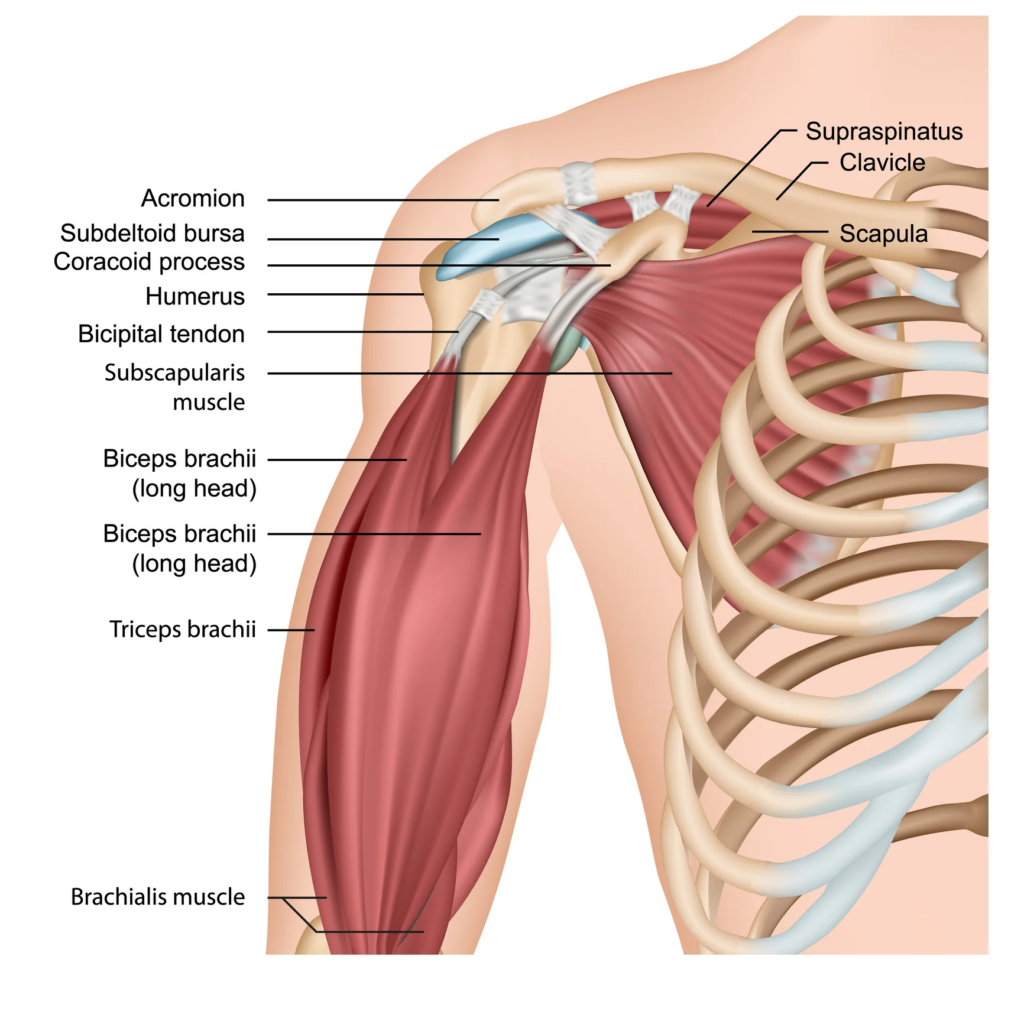 lesión del tendón del bíceps
