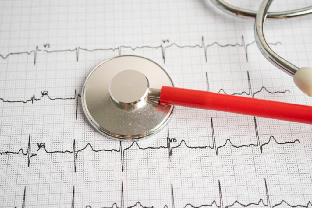 Arritmias cardiacas: síntomas, diagnóstico y tratamiento de estas alteraciones del ritmo cardíaco