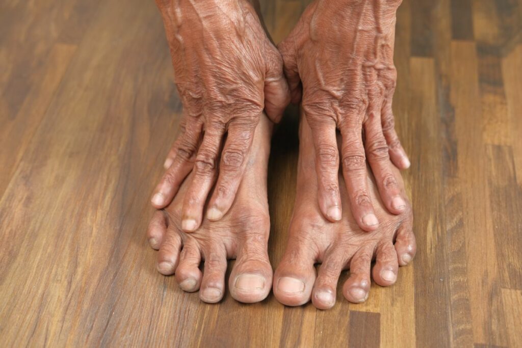 artritis-del-pie
