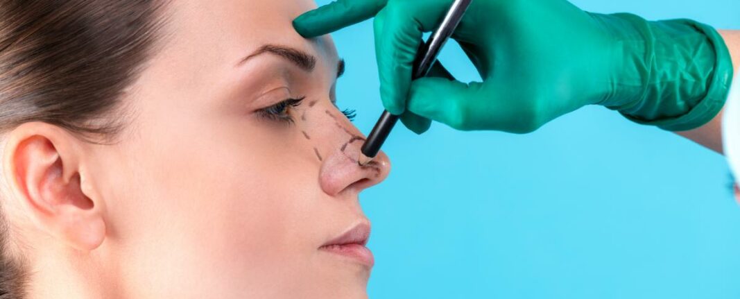 RINOPLASTIA CORRECTORA: Mejora tu salud y estética nasal con este procedimiento