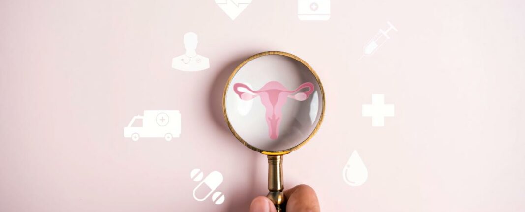 Quistes de ovario: Síntomas, diagnóstico y tratamiento en la salud femenina