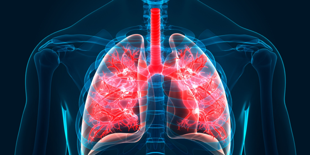 bronquitis pulmones