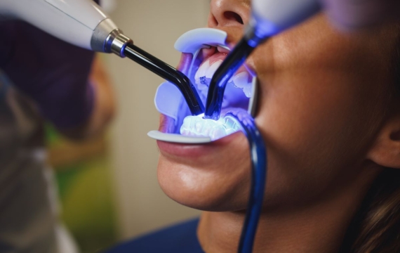 odontología cosmçetica odontología estética