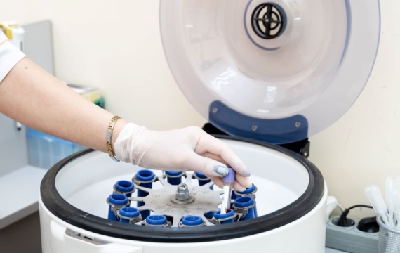 centrifugadora-de-muestras