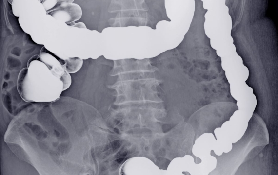 bario-en-valencia bario-en-valencia