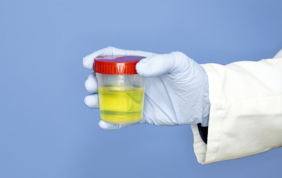 infección-de-orina-en-valencia infección-de-orina-en-valencia