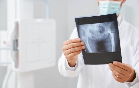 radiografía en Valencia