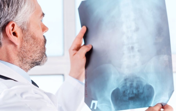 radiología-de-columna radiología-de-columna