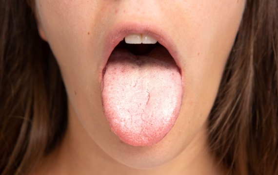 glandulas-salivares-valencia