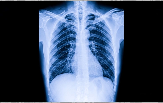 radiografía en Valencia