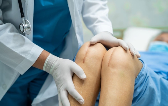 reemplazo-totl-articulacion-rodilla