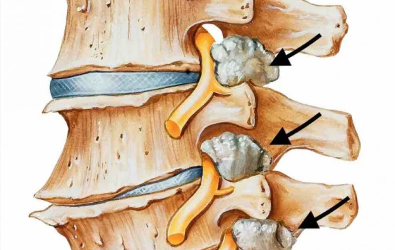 cirugia-cervical-valencia