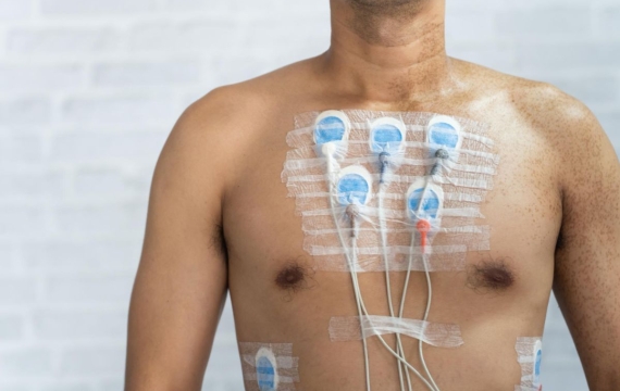 Holter-ECG Holter-ECG-Valencia