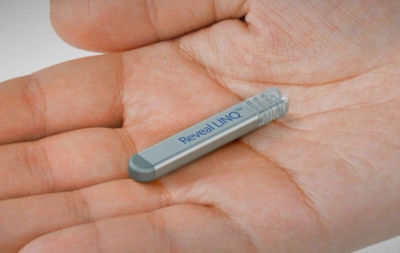 loop-recorder-implantable-valencia loop recorder implantable