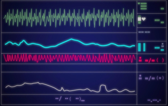 ECG-Electrocardiograma-valencia ECG-Electrocardiograma