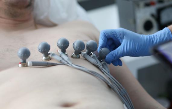 electrocardiograma electrocardiograma en valencia