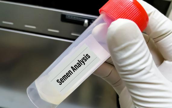 infertilidad en valencia análisis de semen en valencia