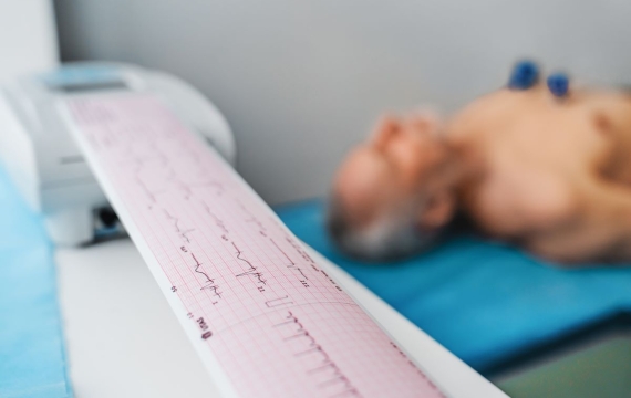 electrocardiograma-en-reposo-en-valencia electrocardiograma-en-reposo-en-valencia