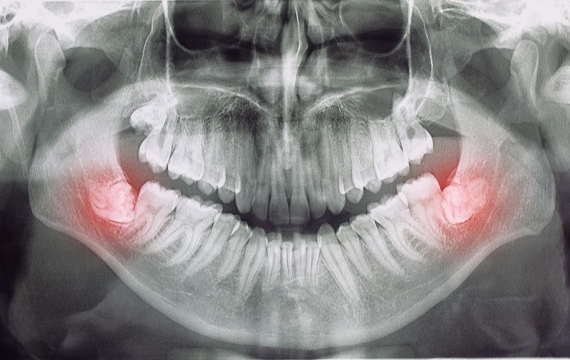 cirugia-maxilofacial-valencia cirugia-maxilofacial-valencia
