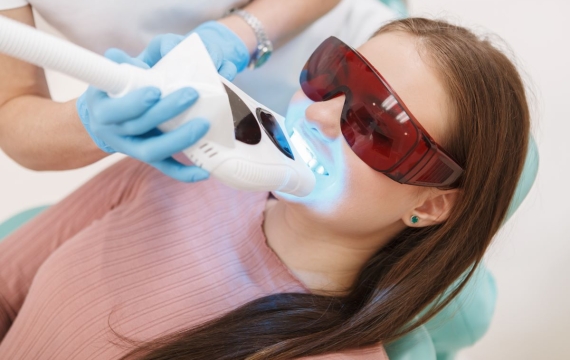 blanqueamiento-dental-valencia blanqueamiento-dental-valencia