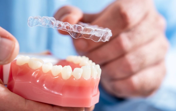 protesis-dental protesis-dental