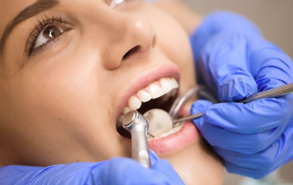 implantes implantes