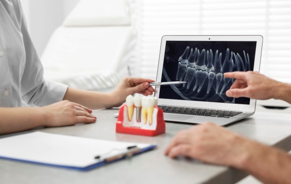 implante-dental implante-dental