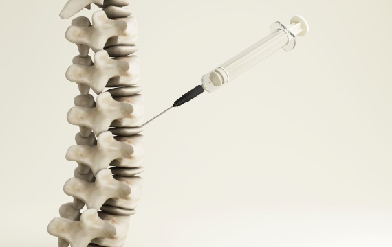 infiltraciones-en-columna-vertebral infiltraciones-en-columna-vertebral