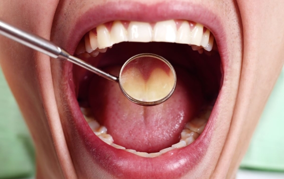 tratamiento-medicina-bucal tratamiento-medicina-bucal