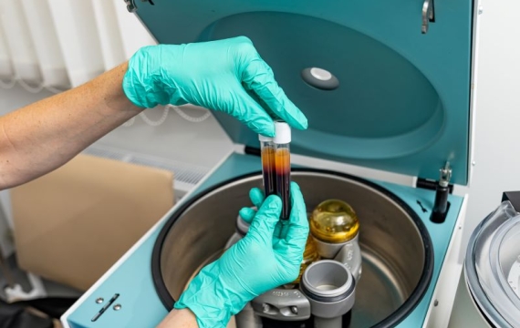centrifugadora-PRP centrifugadora-PRP