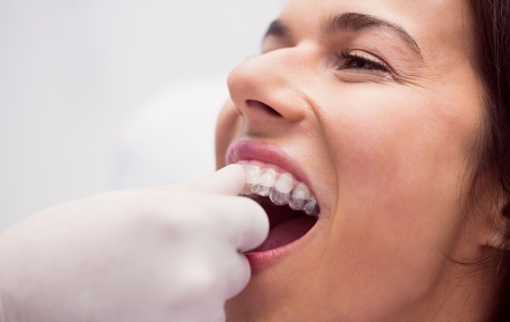 cuidado-protesis-dentales cuidado-protesis-dentales
