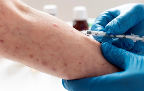 tratamiento-psoriasis tratamiento-psoriasis