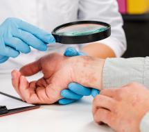 Dermatología Clínica en Valencia Dermatología Clínica en Valencia