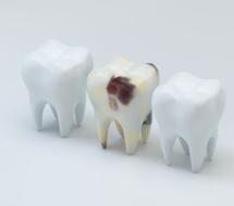 Cariología Cariología en valencia