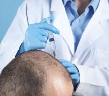 Unidad De Alopecia E Injerto Capilar en Valencia Unidad De Alopecia E Injerto Capilar en Valencia