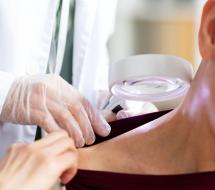 Dermatología Oncológica en valencia Dermatología Oncológica en valencia