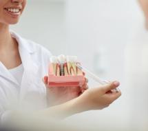 Implantología Implantología en valencia