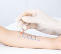 Alergología infantilen valencia