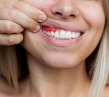 Periodoncia Periodoncia en valencia