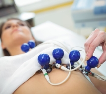 Electrocardiograma-ECG Electrocardiograma-Valencia