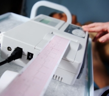 ECG-Electrocardiograma-valencia