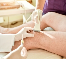 Infiltraciones ecoguiadas de rodilla en Valencia