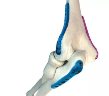 Osteosíntesis rodilla Valencia