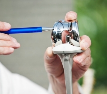 Artroplastia de rodilla en Valencia