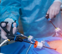 Artroscopia de Rodilla en Valencia